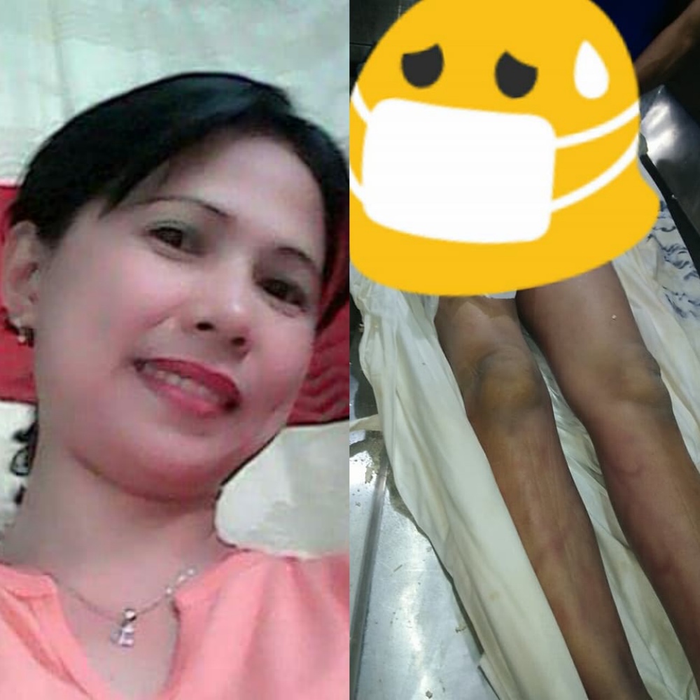 The ofw committed suicide, but her body tells otherwise. [Image Credit: Gracel Ann Hukdong/Facebook]
